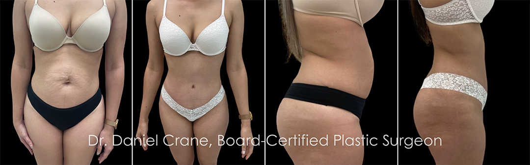 Dr. Daniel Crane Best Body Enhancing Surgery Award